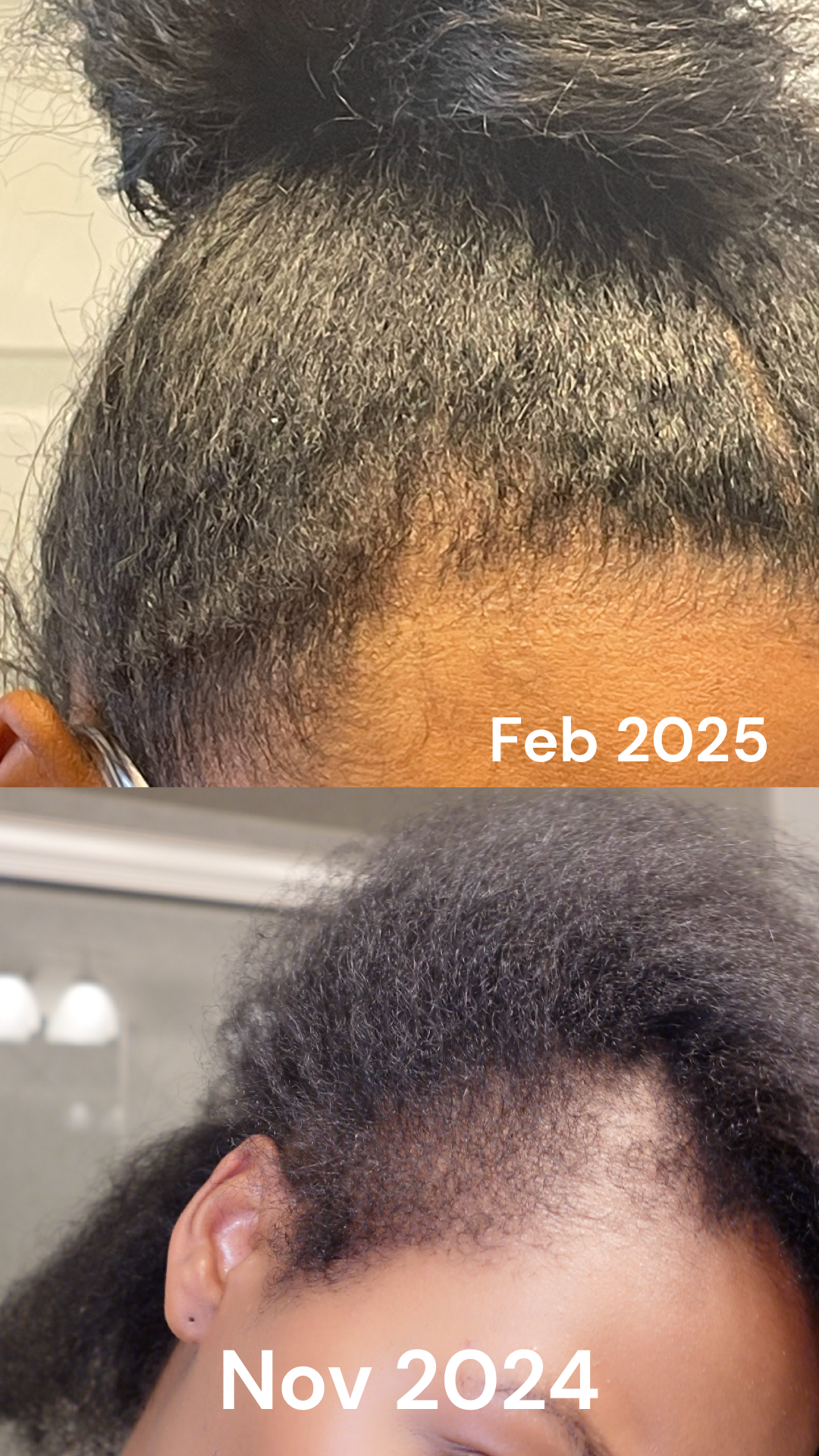 Hair Growth Elixir